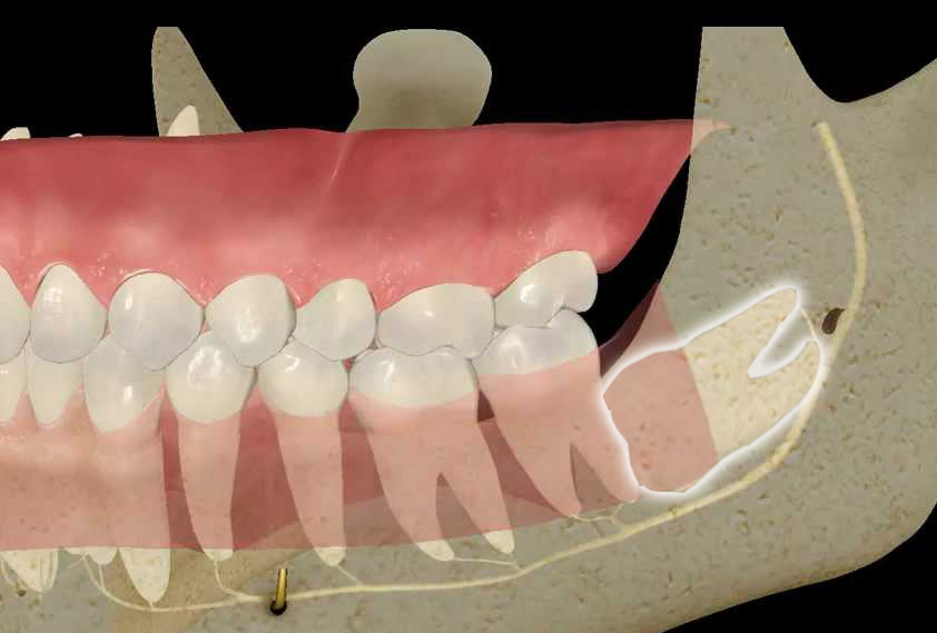 Oral Surgery -