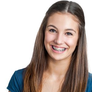 Smiling Teen Girl Showing Dental Braces.